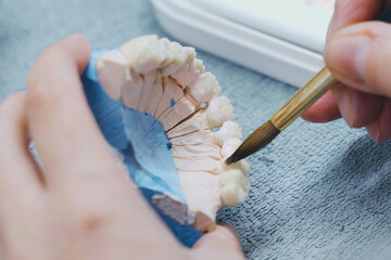 A dental technician paints a denture with a brush.