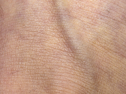 Abstract Vein Body Skin Texture 