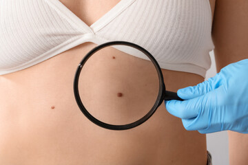 Dermatologist with magnifier examining mole on woman's belly against light background, closeup