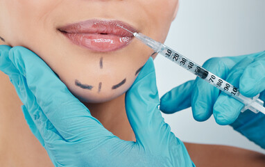 Cosmetic, injection and woman with smile of dermal filler for beauty transformation, treatment or...