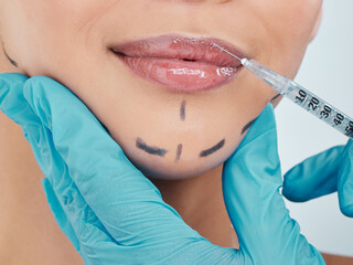 Woman, injection and beauty with lip filler, cosmetic for results in cosmetology in background....