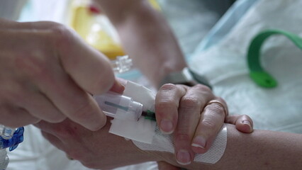 Nurse hand applying medical drip into Patient's hand with IV catheter closeup. hospital equipment and routine