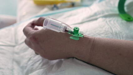 Nursing care, close-up patient's hand at hospital with blood sample bottle attached in vein, nurse...