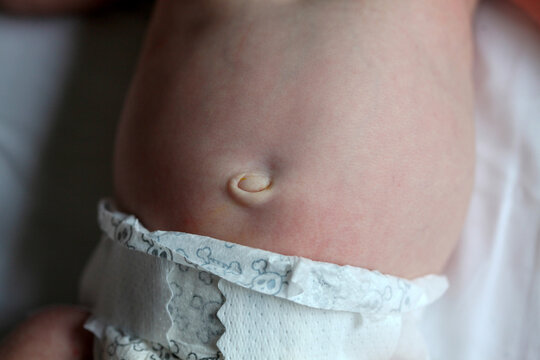 Close Up Of Baby Belly and Diaper