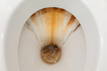 White Toilet Contaminated With Brown Substance