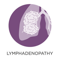 Lymphadenopathy flat style vector illustration in circle layout with type, medical infographic