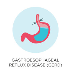 Gastroesophageal Reflux Disease (GERD) with stomach vector icon