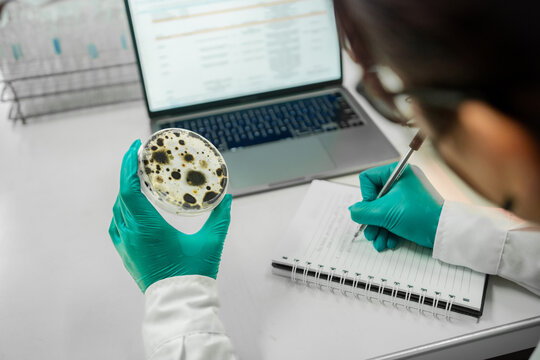 Scientist analyzing microbial culture sample at laboratory