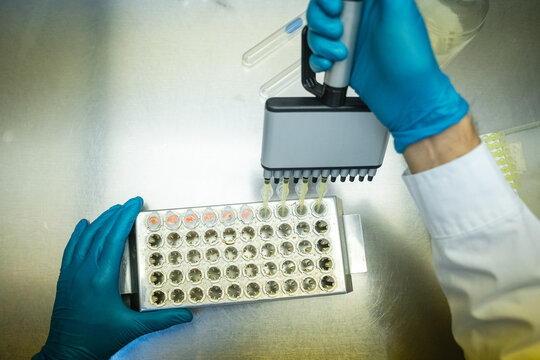 Taking pipette samples at a lab