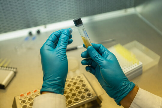 Scientist analyzing a sample in test tube