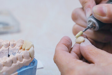 Person Cutting Tooth With Scissors