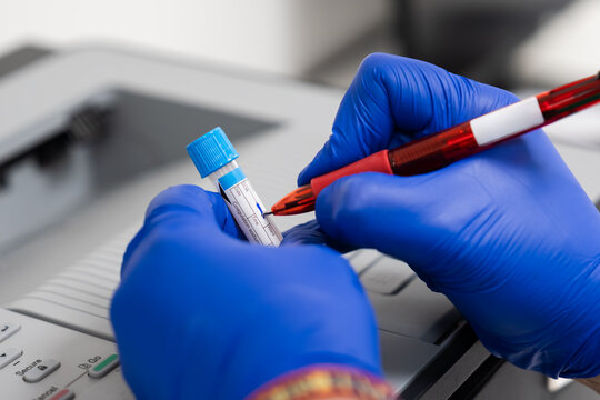 Laboratory technician labeling blood sample
