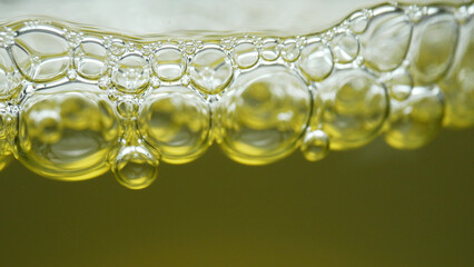 In this macro, urine exhibits pronounced foam formation, possibly indicating elevated protein...