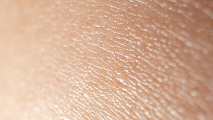 Explore the arm's skin surface in astonishing detail through macro, revealing the epidermal layers,...