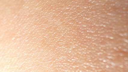 In macro, arm surface skin reveals epidermal layers, sweat glands, and fine hair follicles,...