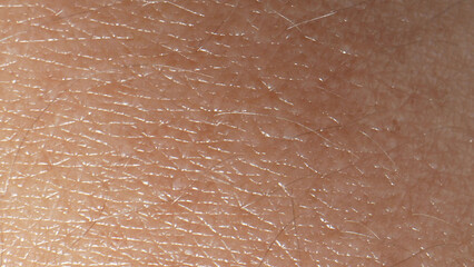 Zoom in on the arm's skin, a surreal landscape unfolds-each pore, wrinkle, and imperfection forming...