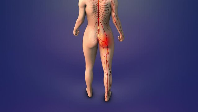 Trigger point for sciatica in human glutes