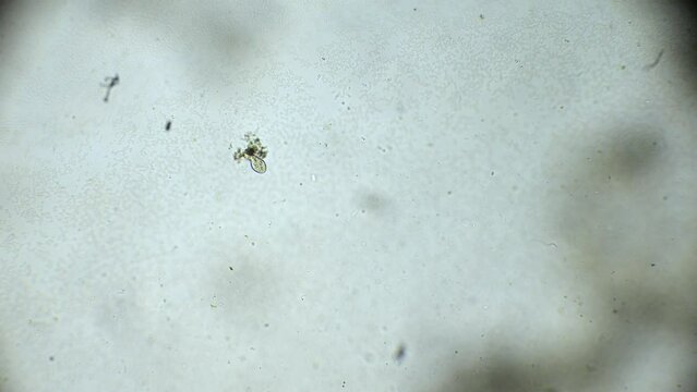 Dive into the microscopic world of a water droplet, where paramecia and spirulina navigate the tiny ecosystem, all seen in great detail.