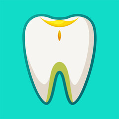 A tooth with a cavity on a blue surface background