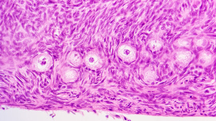 Histology of mammal ovary shows primary follicles. HE staining. Selective focus image