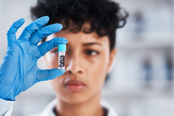 Sample, blood and healthcare in bottle, hand and scientist in lab, working and chemical for...