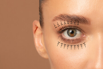 Blepharoplasty concept. Closeup view of lady eye with arrows point in direction of planned...