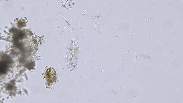 ciliates stylonychia (ciliated protozoan) from a river under the microscope - light microscope x200 magnification