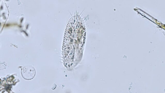 ciliates stylonychia (ciliated protozoan) from a river under the microscope - light microscope x400 magnification