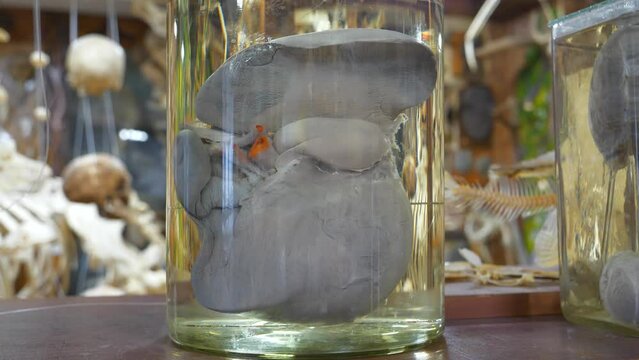 Human liver in glass flask. Major metabolic organ, which performs many essential biological functions such as detoxification of organism, and synthesis of proteins and biochemicals necessary