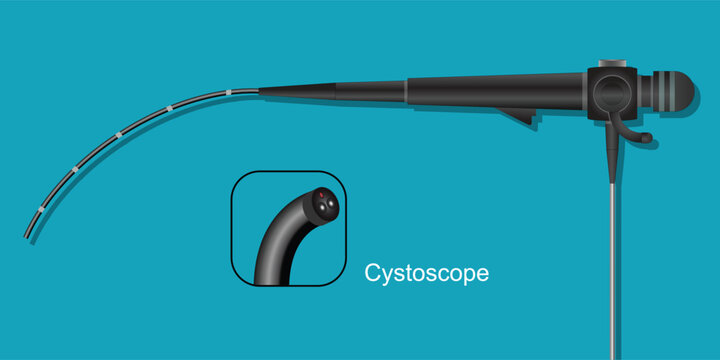 Cystoscope is a hollow tube equipped.