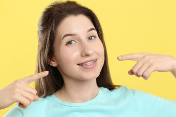 Smiling woman pointing at her dental braces on yellow background