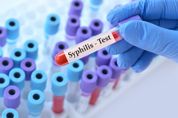 Fototapeta premium Doctor holding a test blood sample tube with Syphilis test on the background of medical test tubes with analyzes.