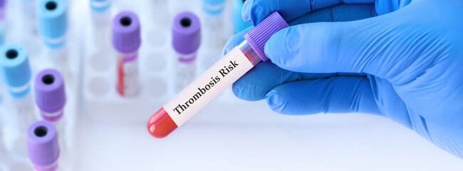 Naklejka premium Doctor holding a test blood sample tube with Thrombosis Risk test on the background of medical test tubes with analyzes.
