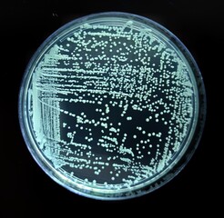 White round colonies of yeast on a Petri dish. An exhaustive touch to check the purity of the...