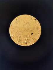 Live preparation of yeast under a light immersion microscope