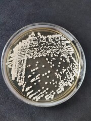 Yeast exhaustion streak on YPD medium to determine the purity of the culture. The yeast formed white, shiny, round colonies with a convex profile and a smooth edge
