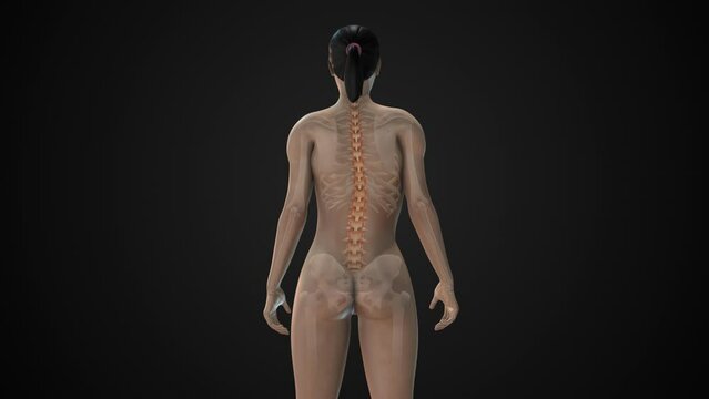 Scoliosis of the spine medical condition