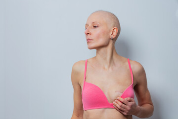 Woman in underwear post-mastectomy portrait, show scar on breast