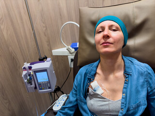 Patient woman look at camera during chemotherapy in hospital