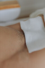 Bikini waxing,Intimate waxing, Hair removal, bikini area. Cosmetic Beauty Clinics