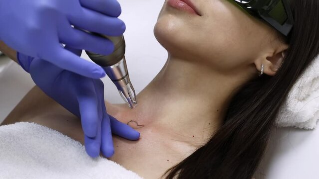 Doctor beautician makes laser tattoo removal on the neck of a young brunette woman in the salon. Aesthetic cosmetology, skin treatment and tattoo removal.