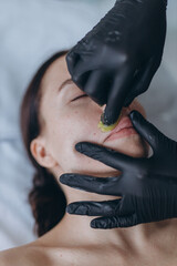 Removing hair above upper lip of young woman in salon. shugaring depilation.