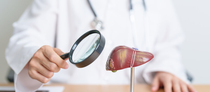 Doctor with human Liver model and Magnifying glass. Liver cancer and Tumor, Jaundice, Viral Hepatitis A, B, C, D, E, Cirrhosis, Failure, Enlarged, Hepatic Encephalopathy and Ascites Fluid in Belly