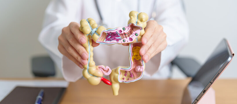Doctor with human Colon anatomy model and tablet. Colonic disease, Large Intestine, Colorectal cancer, Ulcerative colitis, Diverticulitis, Irritable bowel syndrome and Digestive system