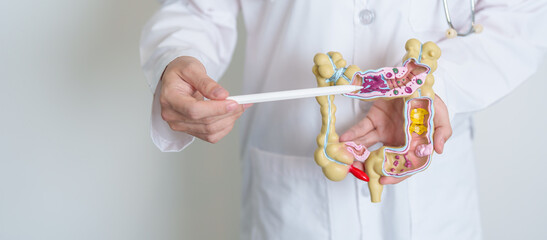 Doctor holding human Colon anatomy model. Colonic disease, Large Intestine, Colorectal cancer,...