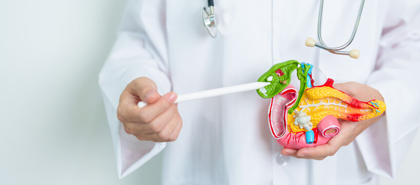 Doctor with human Pancreatitis anatomy model with Pancreas, Gallbladder, Bile Duct, Duodenum, Small intestine. Pancreatic cancer, Acute and Chronic pancreatitis,  Digestive system and Health concept