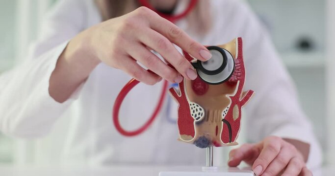 Anatomical model of rectum for hemorrhoids and doctor with stethoscope