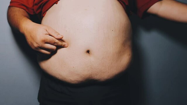 Man pointing own unhealthy big belly with visceral or subcutaneous fats. Pose health risk.