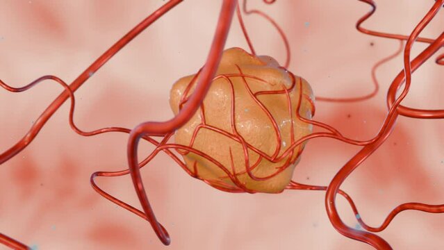 3d rendering of cancer requires a blood supply to deliver the nutrients and oxygen it needs to grow and survive