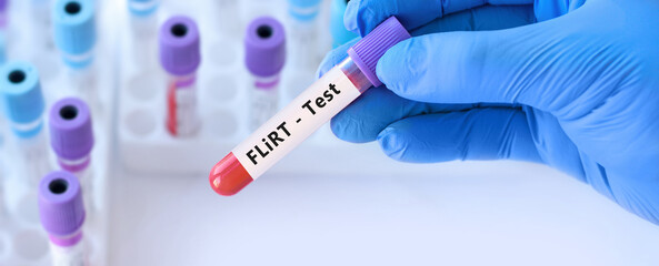Obraz premium Doctor holding a test blood sample tube for the detection of the virus FliRT on the background of medical test tubes. Symptoms with FLiRT are the same as with omicron 